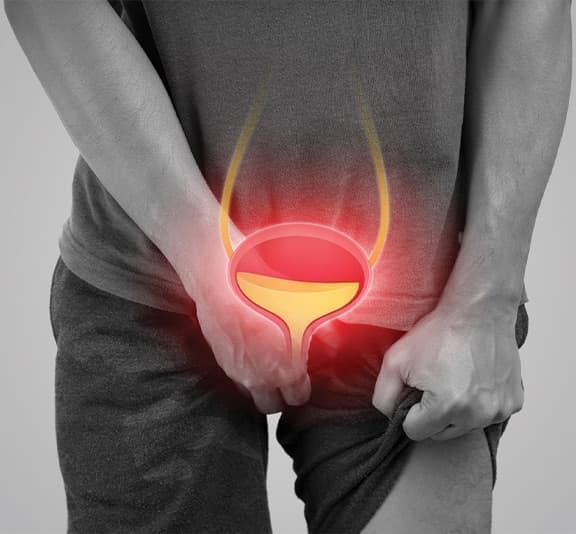 Prostate Enlargement