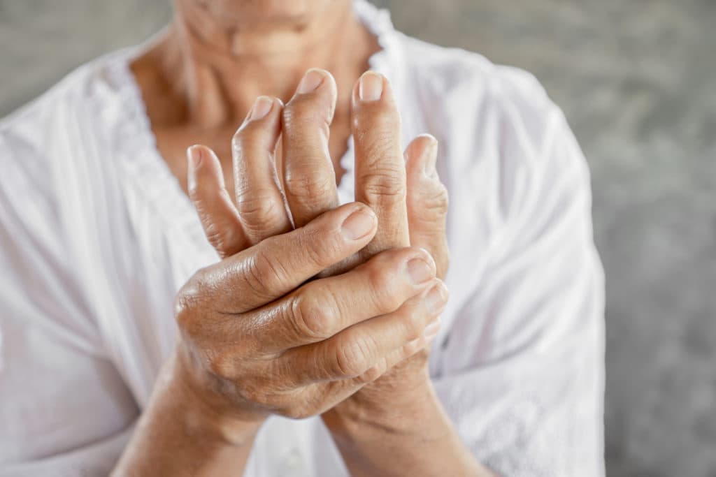 Rheumatoid Arthritis