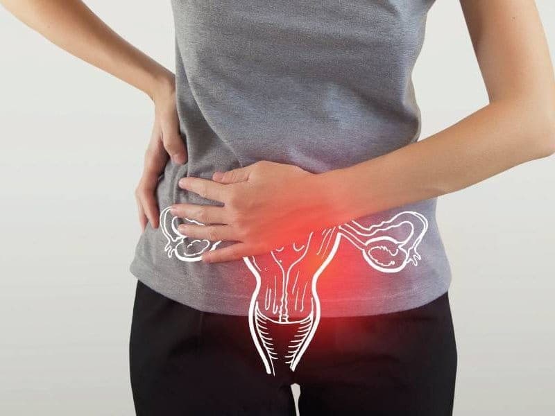 Dysfunctional Uterine Bleeding